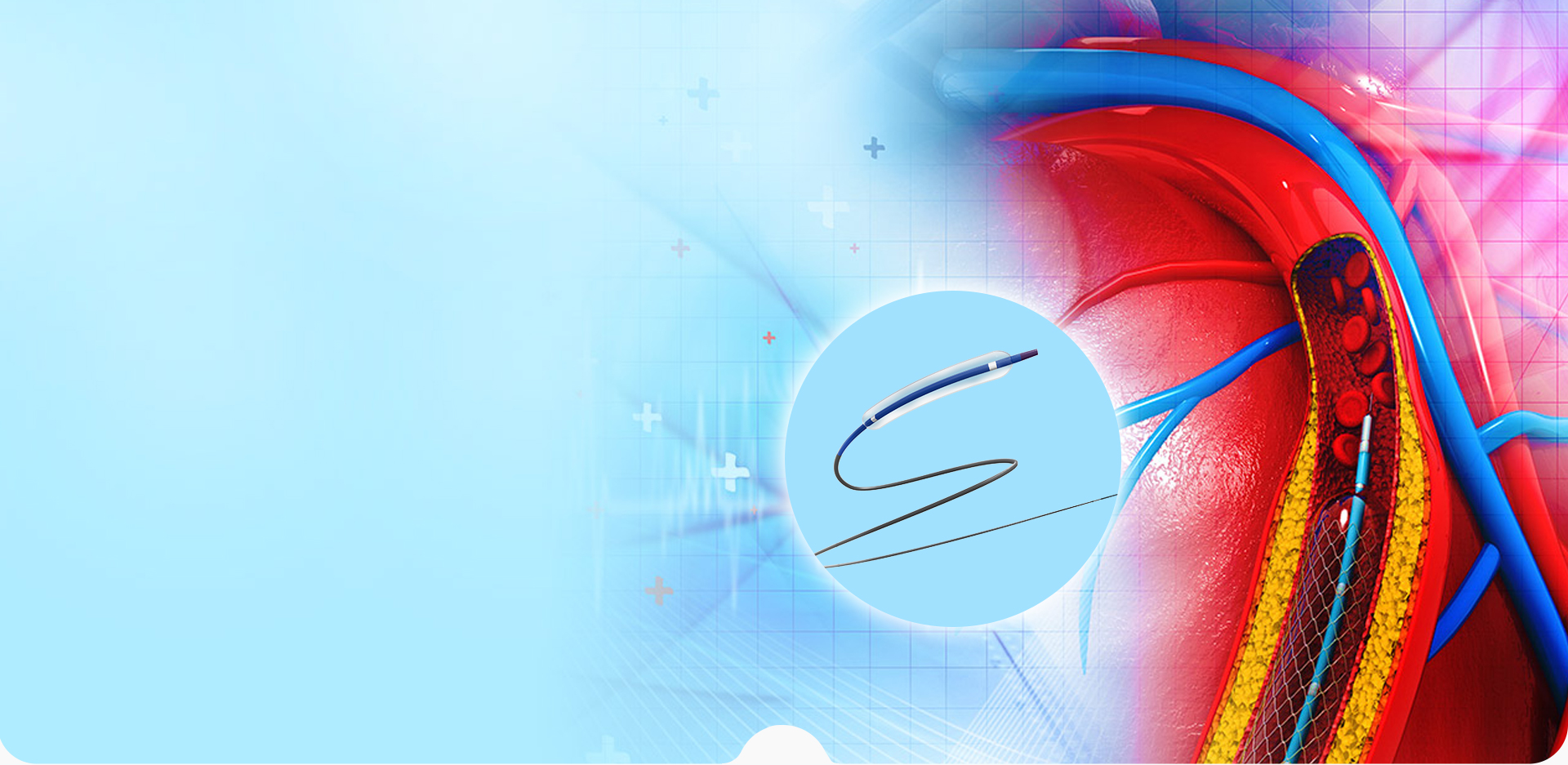 NINGBO LINSTANT POLYMER MATERIALS CO,. KFT.