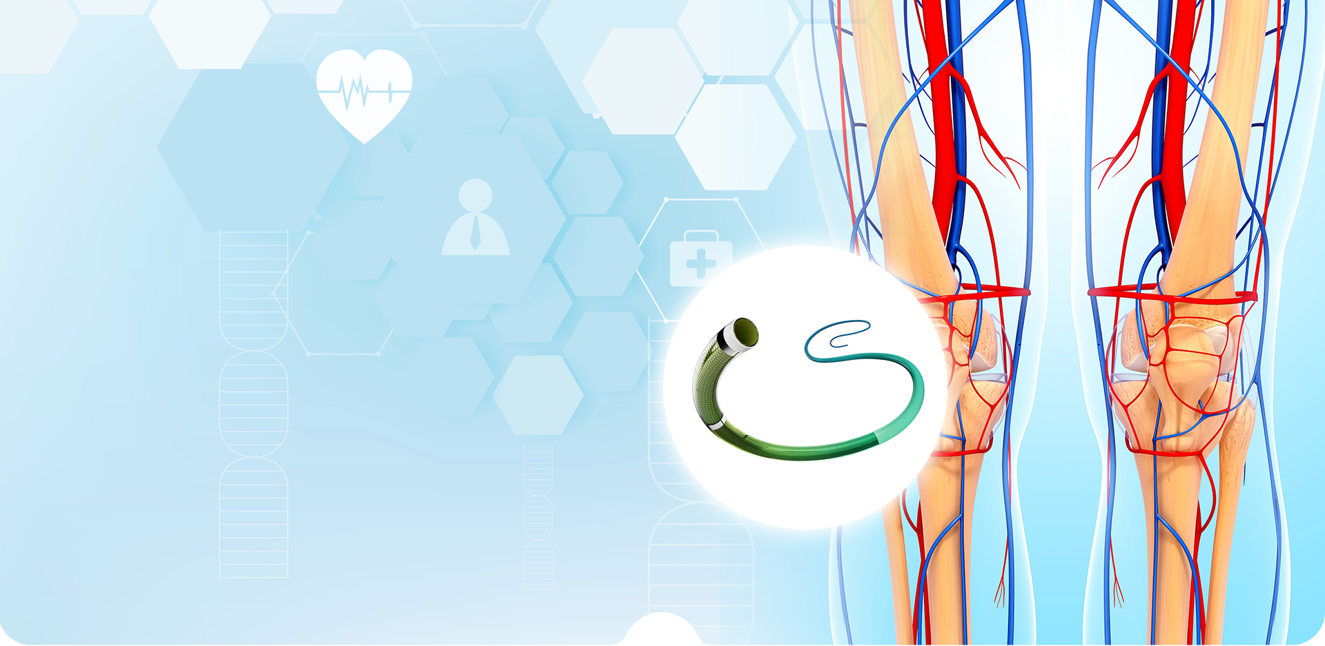 NINGBO LINSTANT POLYMER MATERIALS CO,. KFT.